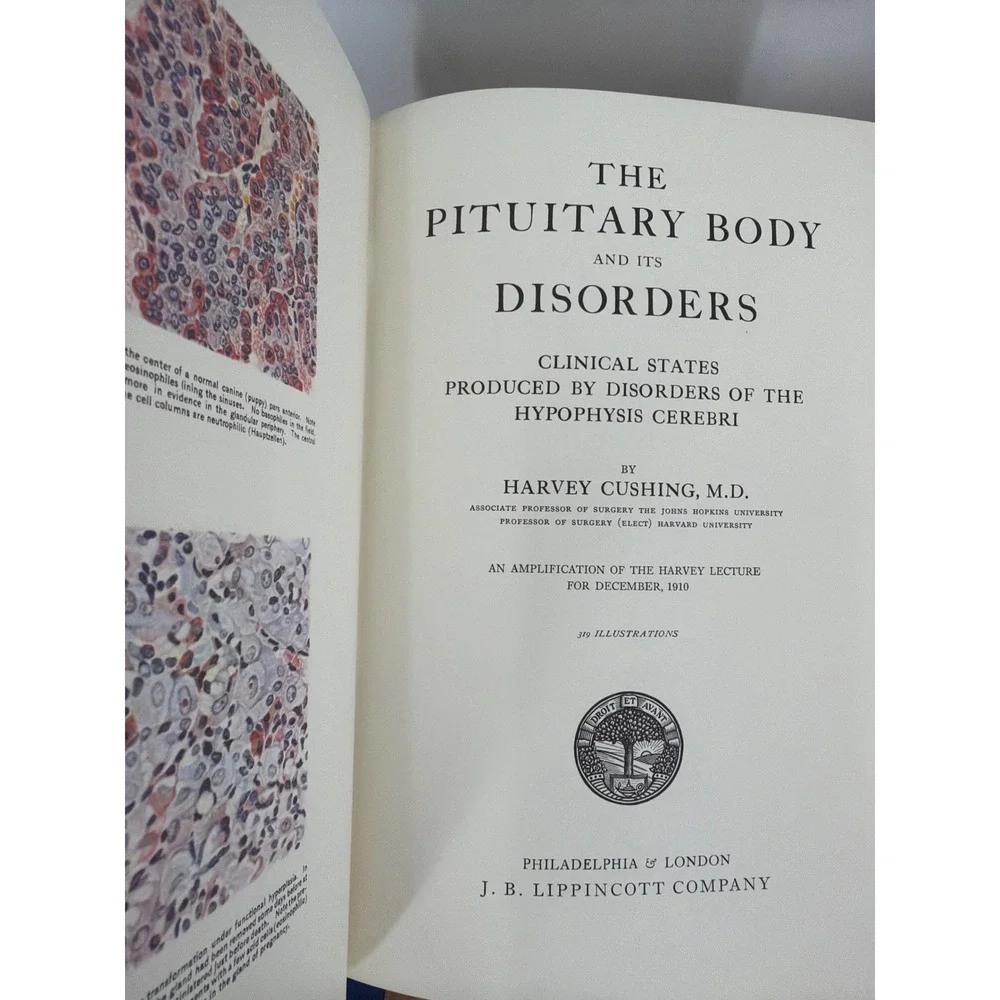 The Pituitary Body and Its Disorders Harvey Cushing Classics of Medicine 1979